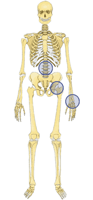 Osteodensitometrie